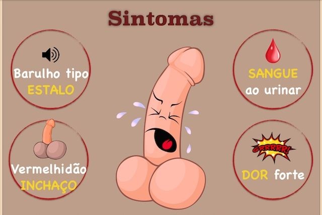 como-identificar-e-tratar-a-fratura-do-penis-1-1-6 como-identificar-e-tratar-a-fratura-do-penis-1-1-6