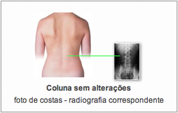 coluna normal.png